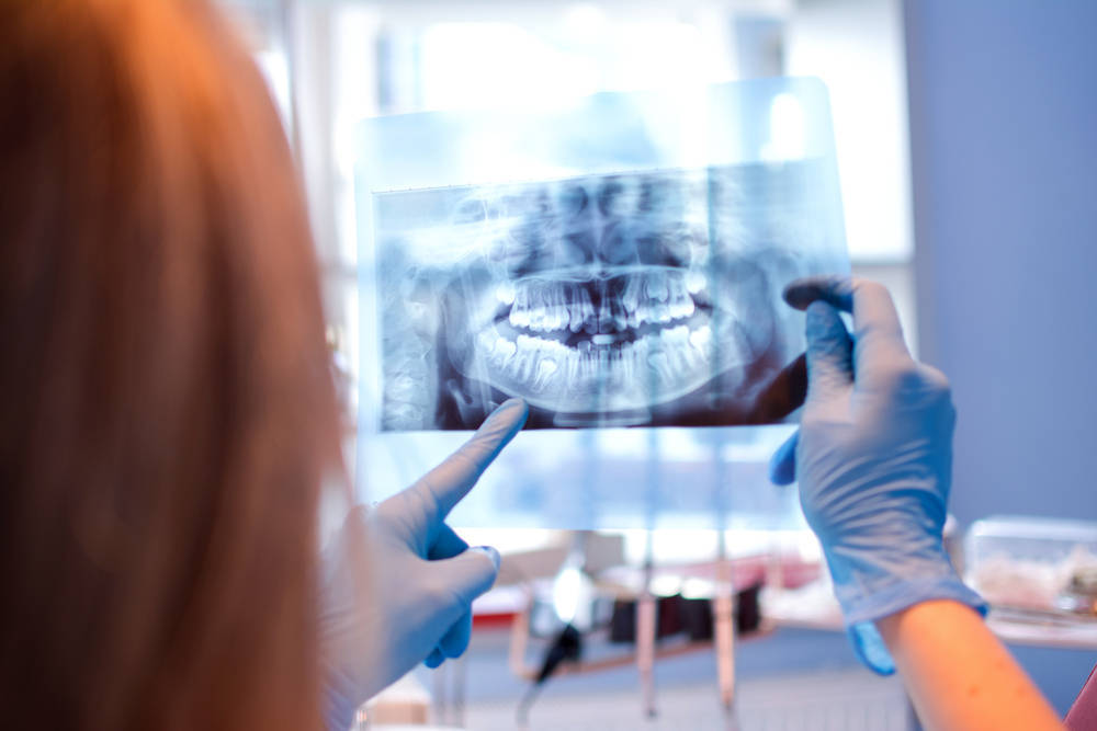 Conoce los diferentes tipos de radiografías dentales que te puede realizar tu especialista en salud bucal
